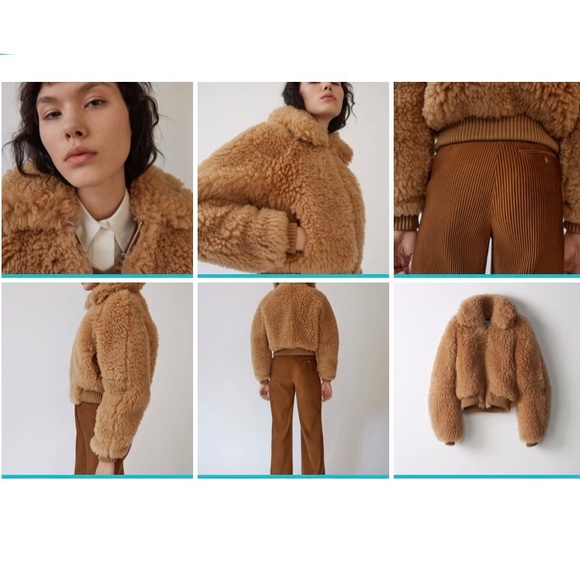 Acne - Picture 4 of 8